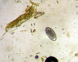 Foto: Rode lebmaagworm